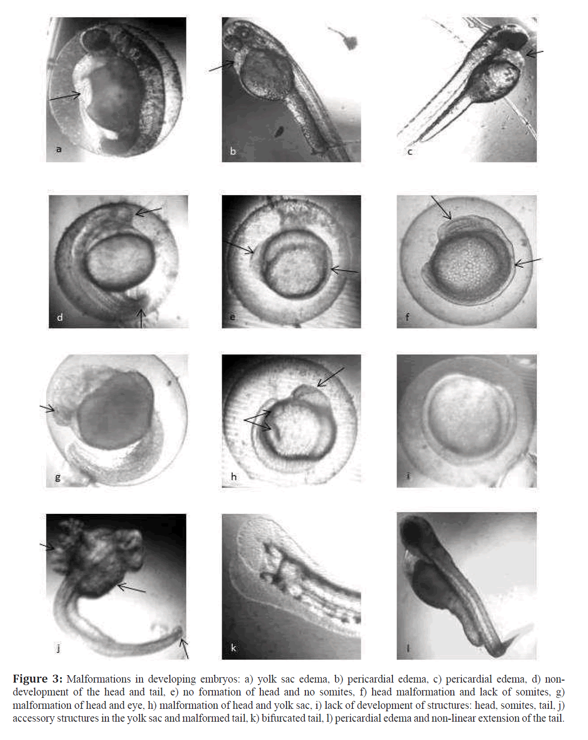 Use Of The Zebrafish Embryo Toxicity Test For Risk Assessment Purpose Case Study Insight Medical Publishing